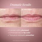 Double Fix™ for Lips Plumping & Vertical Line Treatment, , hi-res